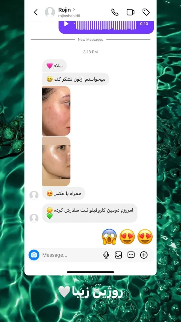 رضایت مشتری از کلروفیل هیلر