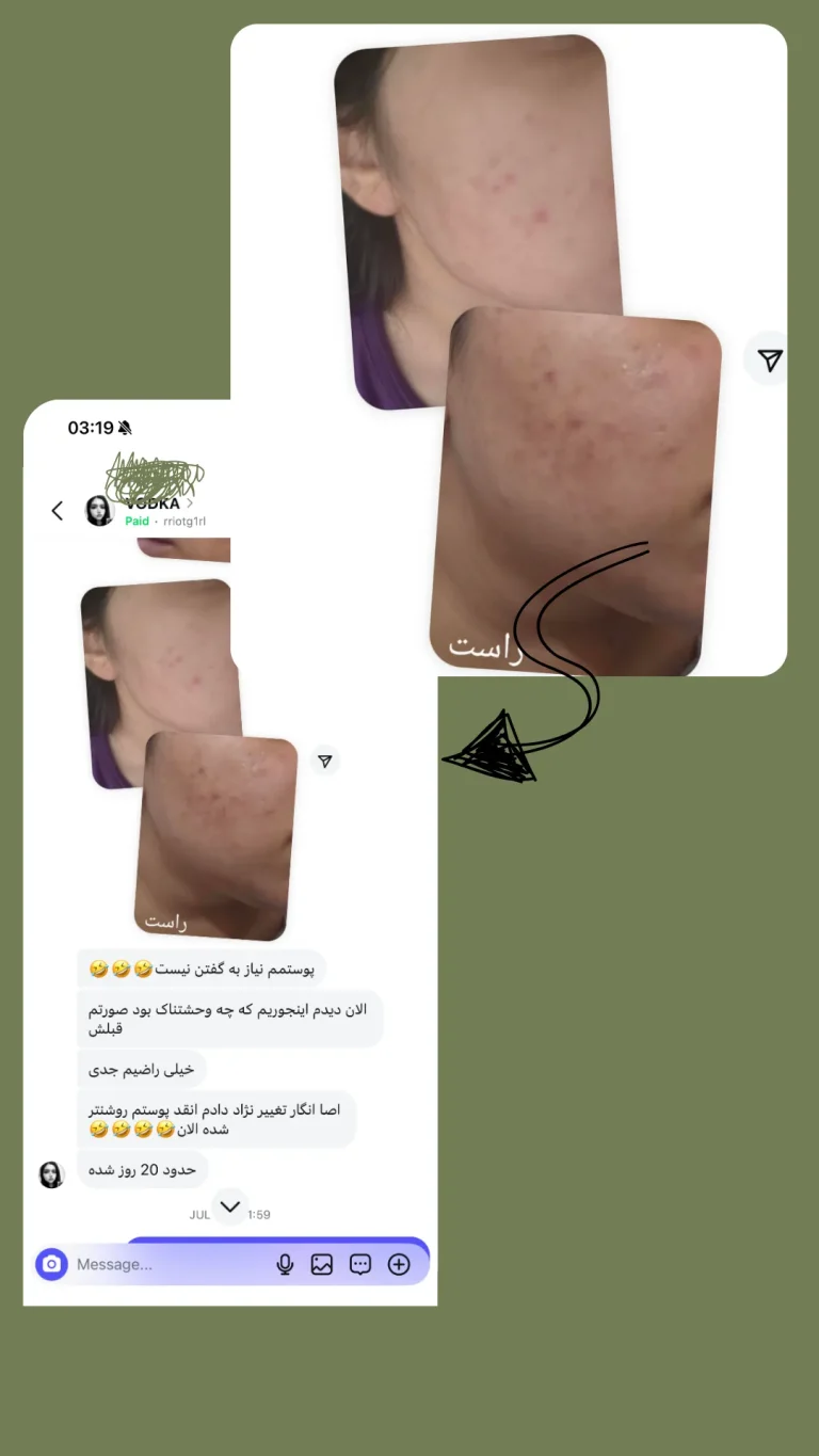 نتیجه استفاده از کلروفیل هیلر پس از 20 روز